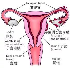 口服“他莫昔芬”子宫内膜增厚怎么办?