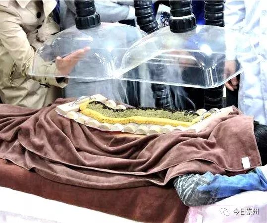 「崇州妇幼」神奇督脉灸——冬日里的健康火！