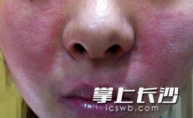 长沙一女子每天骑车吹冷风,长沙一女子持续高烧