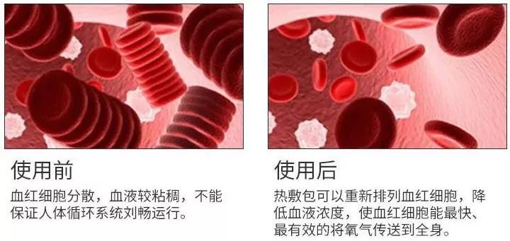 脖子酸痛怎么缓解仪器,脖子肩膀酸疼怎么缓解