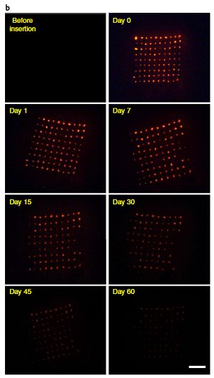 避孕贴片是用一层纸还是一层皮的,避孕贴片的正确使用方法