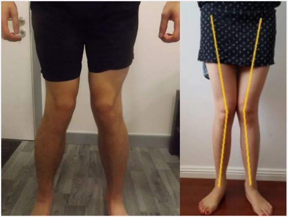 多功能美腿器训练大腿肌肉,美腿瑜伽训练大腿肌肉