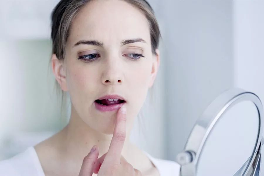 唇裂唇干用什么口红,长期唇干唇裂脱皮怎么回事