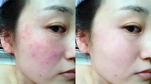 用完它素颜去见前男友，也能让对方后悔！