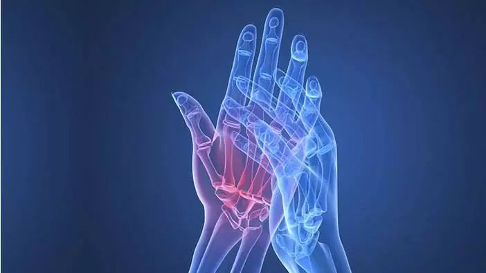 名医话养生保护关节,养生专家讲风湿