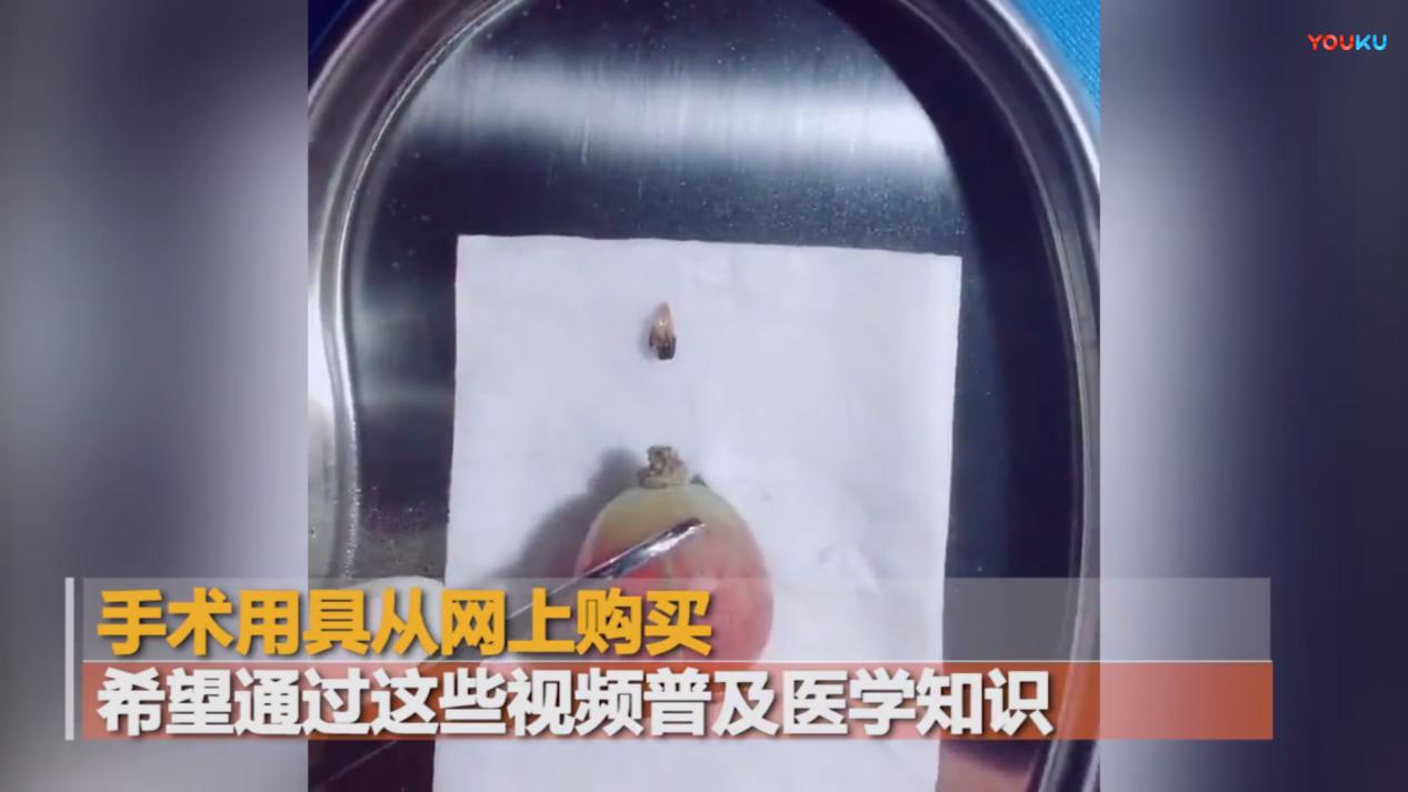 来者不拒!外科医生竟拿它们来练手