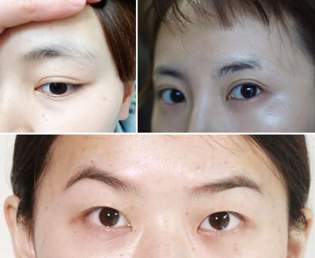 残眉修复,残眉画眉