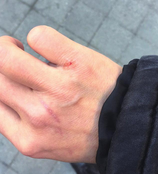 西班牙银行账户被封,西班牙银行账号被封了