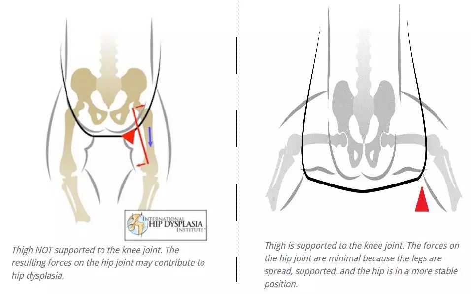 婴儿背带的利和弊,婴儿背带到底实不实用