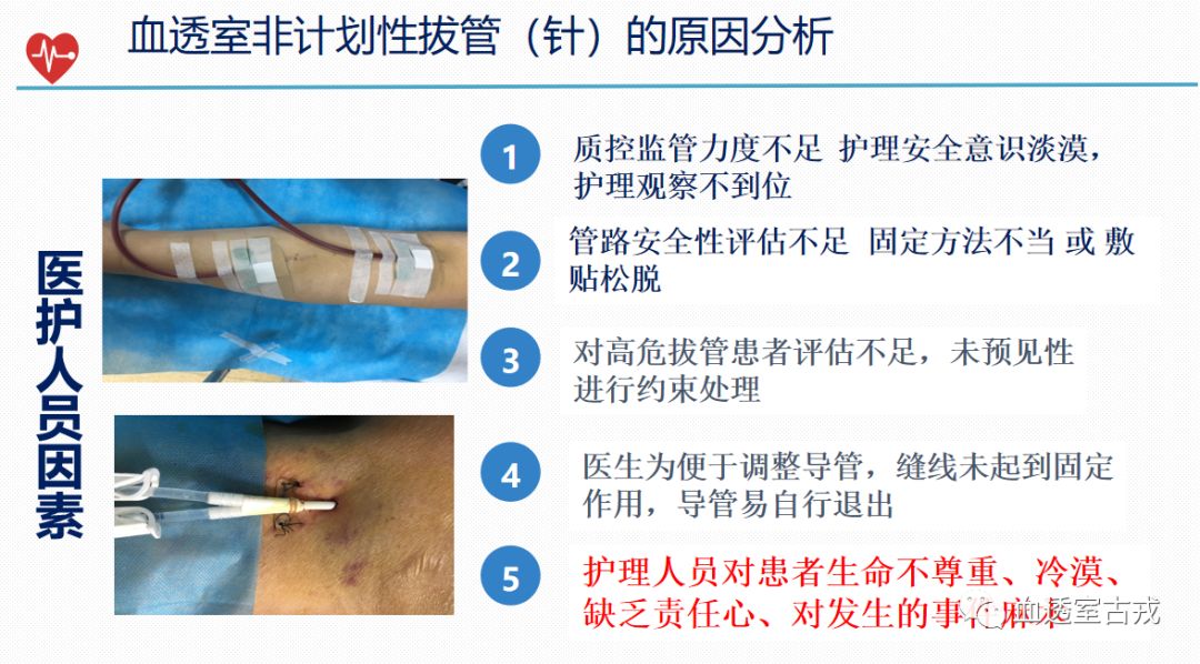 透析穿刺针脱落整改措施,透析过程中穿刺针滑脱怎么办