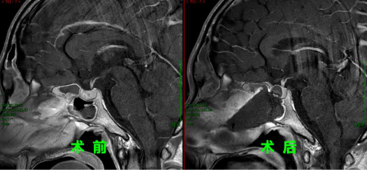 22岁小伙罕见病,22岁小伙患罕见疾病