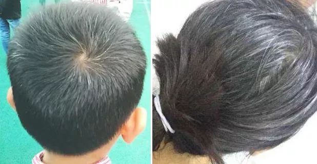 澳洲纯天然植物染发剂,纯天然不伤头发的染发剂