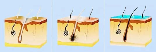 澳洲纯天然植物染发剂,纯天然不伤头发的染发剂