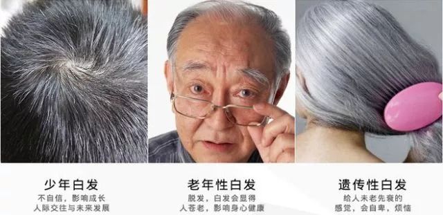 澳洲纯天然植物染发剂,纯天然不伤头发的染发剂