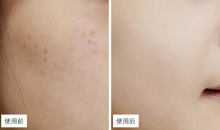 “从LAMER用回片仔癀”！国货药妆之光，奶奶辈就在用，国外买价格翻5倍