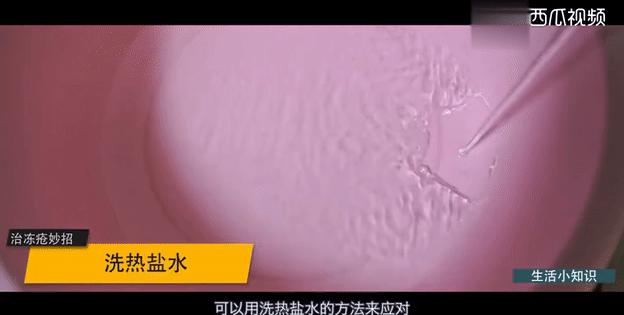 冻疮使用热盐水,用热水袋可以治疗冻疮吗