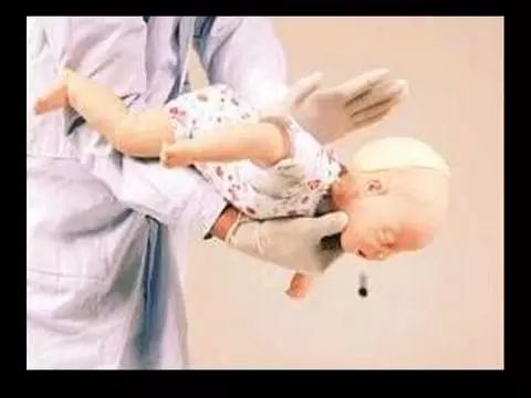 吞咽异物卡在嗓子里该怎么办,吃东西卡到喉咙用什么急救法