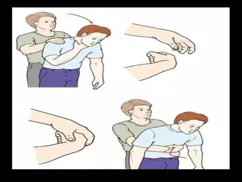 吞咽异物卡在嗓子里该怎么办,吃东西卡到喉咙用什么急救法