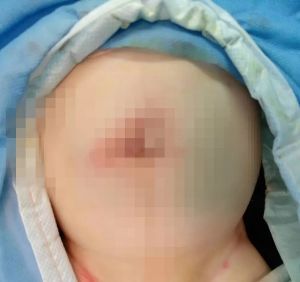 满月宝宝肚子咕噜咕噜又拉粑粑,宝宝肚子鼓得厉害