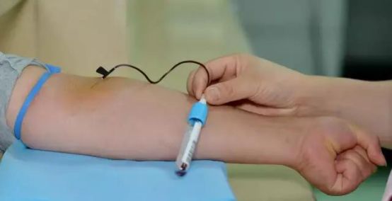 刺血后刺血地方胀痛是什么原因,刺血疗法出不来血是什么原因