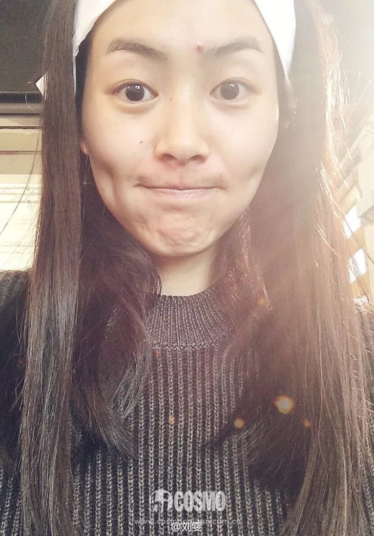 沈梦辰用痔疮膏治痘,痔疮膏真的能止血吗