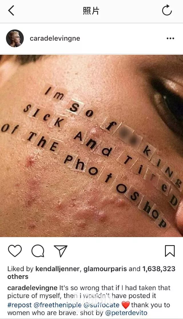 美人计|顽固一年的闭口终于在夏天之前消退了,我用了这些