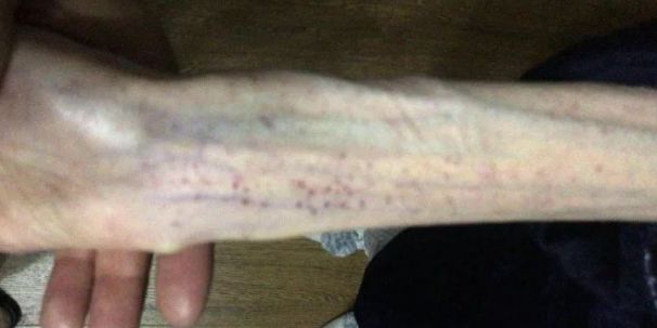 「新世相」高三女生3个月只吃黄瓜！出大事了！妈妈哭死：怎么劝都不听