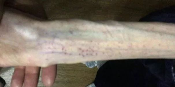 杭州高三女生3个月只吃黄瓜!结果出事了!妈妈泪崩:怎么劝都不听