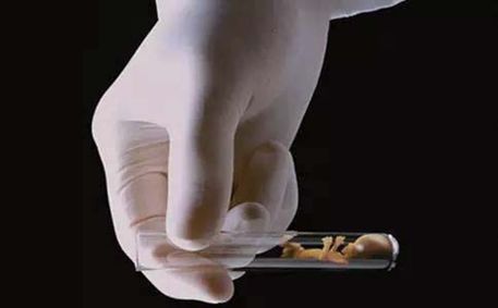 未婚女孩捐一次卵有危害吗,女性捐卵子对身体有伤害吗