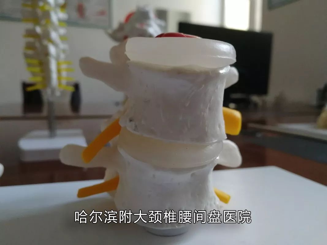 你家睡啥床？你常玩手机？腰痛难忍反复发作、久治不愈，腰间的不能承受之痛该如何缓解？