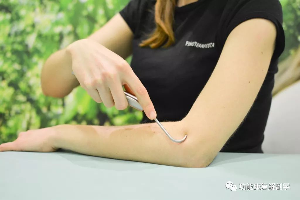 肱骨外上髁炎网球肘,网球肘肱骨外上髁炎如何按摩视频