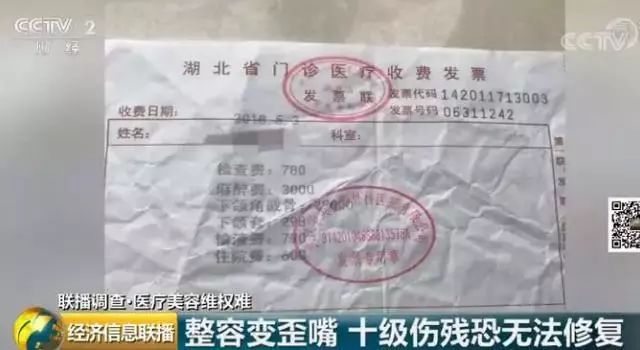 整容脸被打伤如何赔偿,整容10级伤残赔偿标准