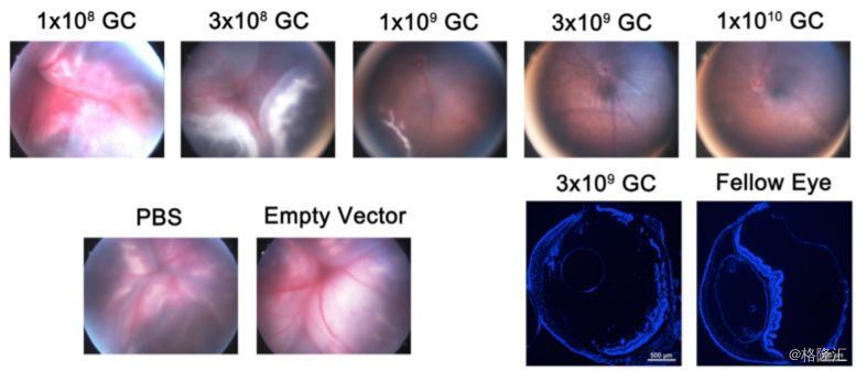 Regenxbio(RGNX.O:基因治疗界新秀崭露头角