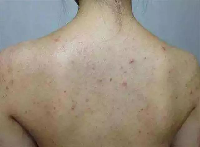 教科书级瘦身法！刷完一身爽的沐浴经络刷，通经络、减脂肪、去角质，让你边洗澡边瘦！