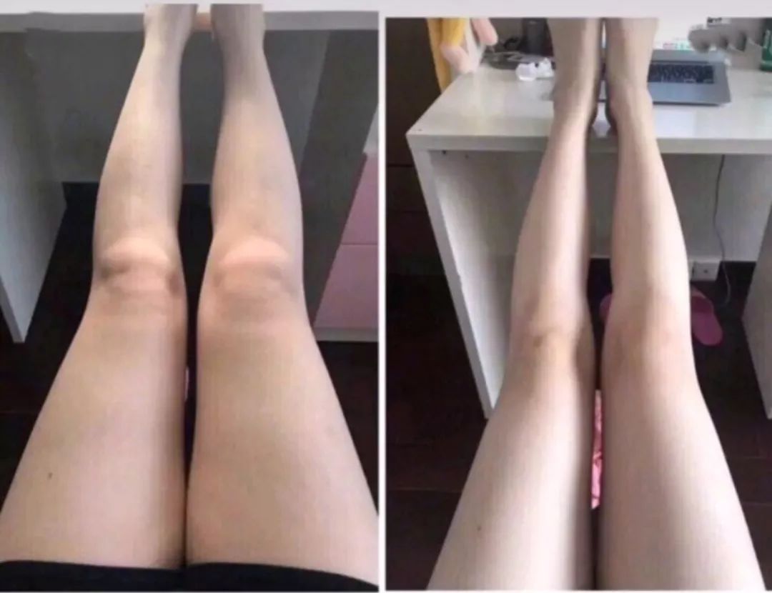 教科书级瘦身法！刷完一身爽的沐浴经络刷，通经络、减脂肪、去角质，让你边洗澡边瘦！