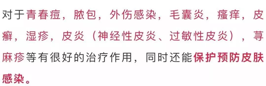 脚气湿疹止痒最快的软膏,湿疹止痒膏可以治脚气吗