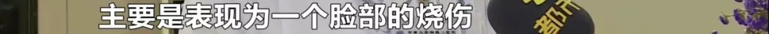 湘雅附二3天20例！男童眼部受伤血流不止，只因……快保护好你家孩子！