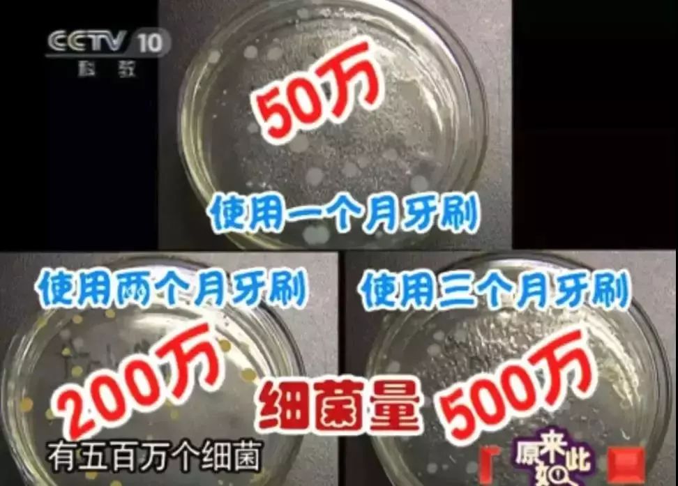 哪款电动牙刷清洁牙垢效果好,刷牙为什么需要竖着刷