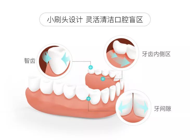 哪款电动牙刷清洁牙垢效果好,刷牙为什么需要竖着刷