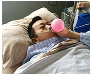 类风湿关节炎间质肺炎怎么治疗,类风湿关节炎肺受累怎么治