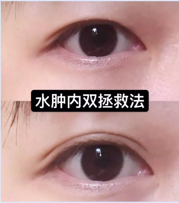 眼袋黑眼圈细纹抹一抹,去眼袋黑眼圈涂抹方法