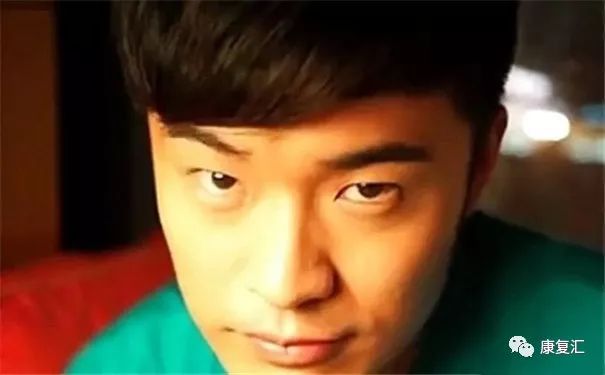 面瘫眉毛怎么恢复得快,面瘫后眉毛一高一低会正常吗