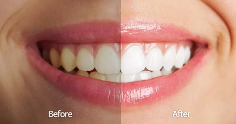 拥有着最治愈人心的笑容,拥有治愈笑容的男生