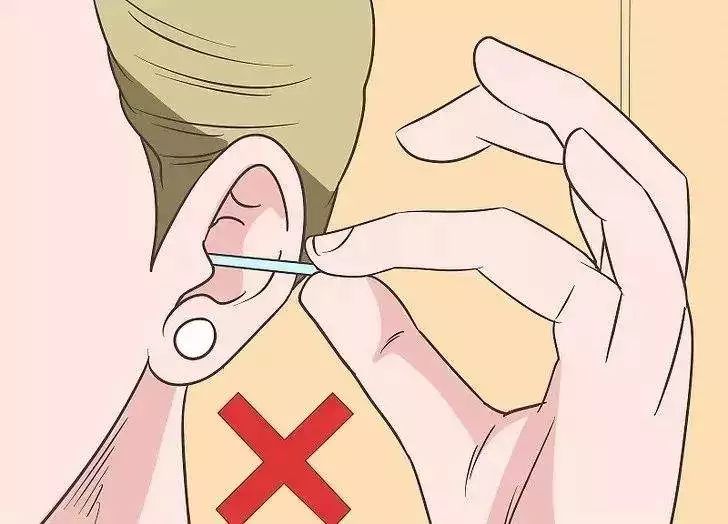 耳朵游泳进水嗡嗡响出不来,游泳耳朵里进水排不出来怎么办