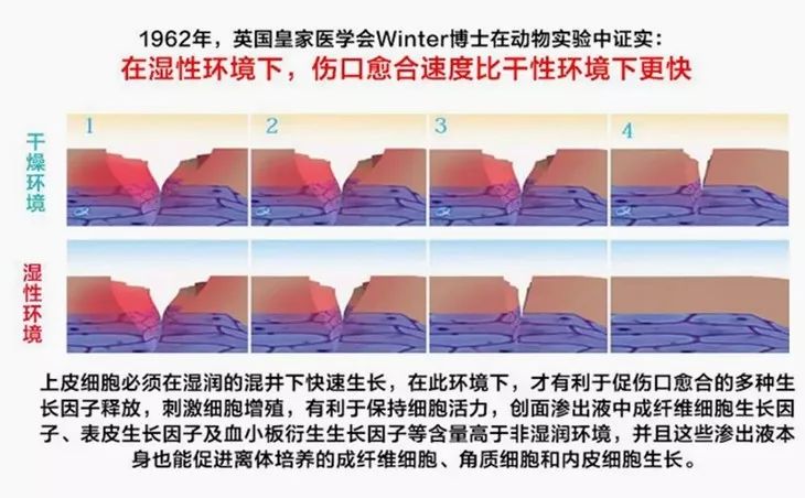 喷雾式防水创可贴,液体创可贴有效果吗
