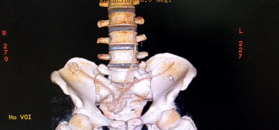 男子肛门塞进三条泥鳅，知道原因医生要哭了…