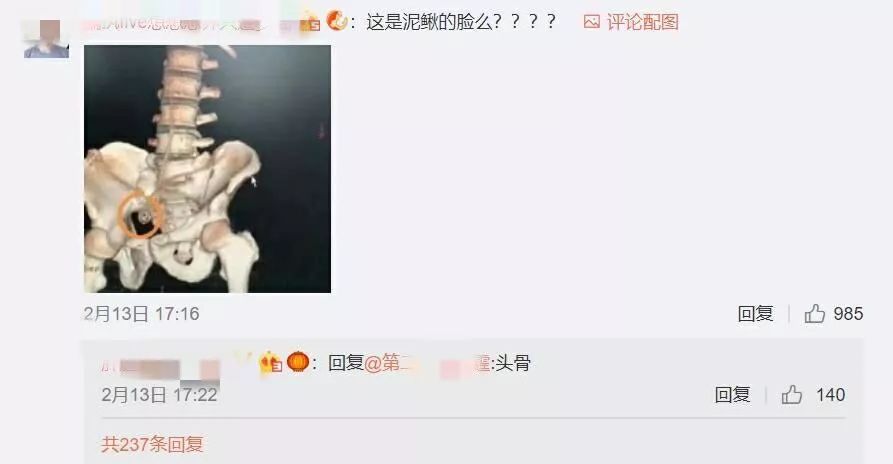 男子肛门塞进三条泥鳅，知道原因医生要哭了…