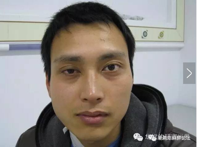 落枕了怎么办最快最有效方法,落枕了怎么办按什么穴位