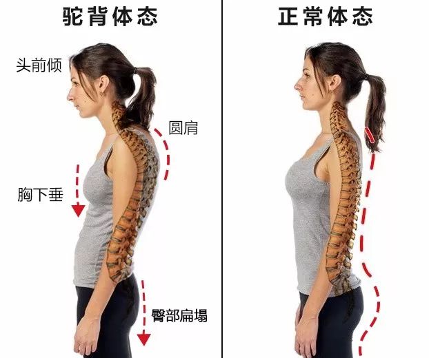 久坐相当“慢性自杀”！德国骨科专家打造的“撑腰”神器，坐9小时腰也不痛，20年颈脊椎病都好了