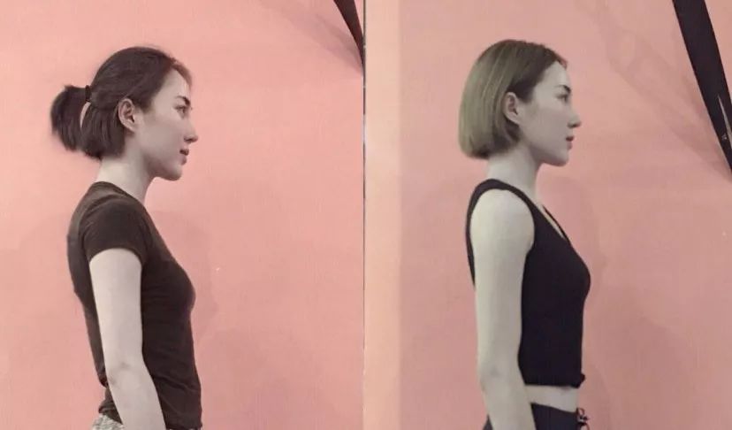 久坐相当“慢性自杀”！德国骨科专家打造的“撑腰”神器，坐9小时腰也不痛，20年颈脊椎病都好了